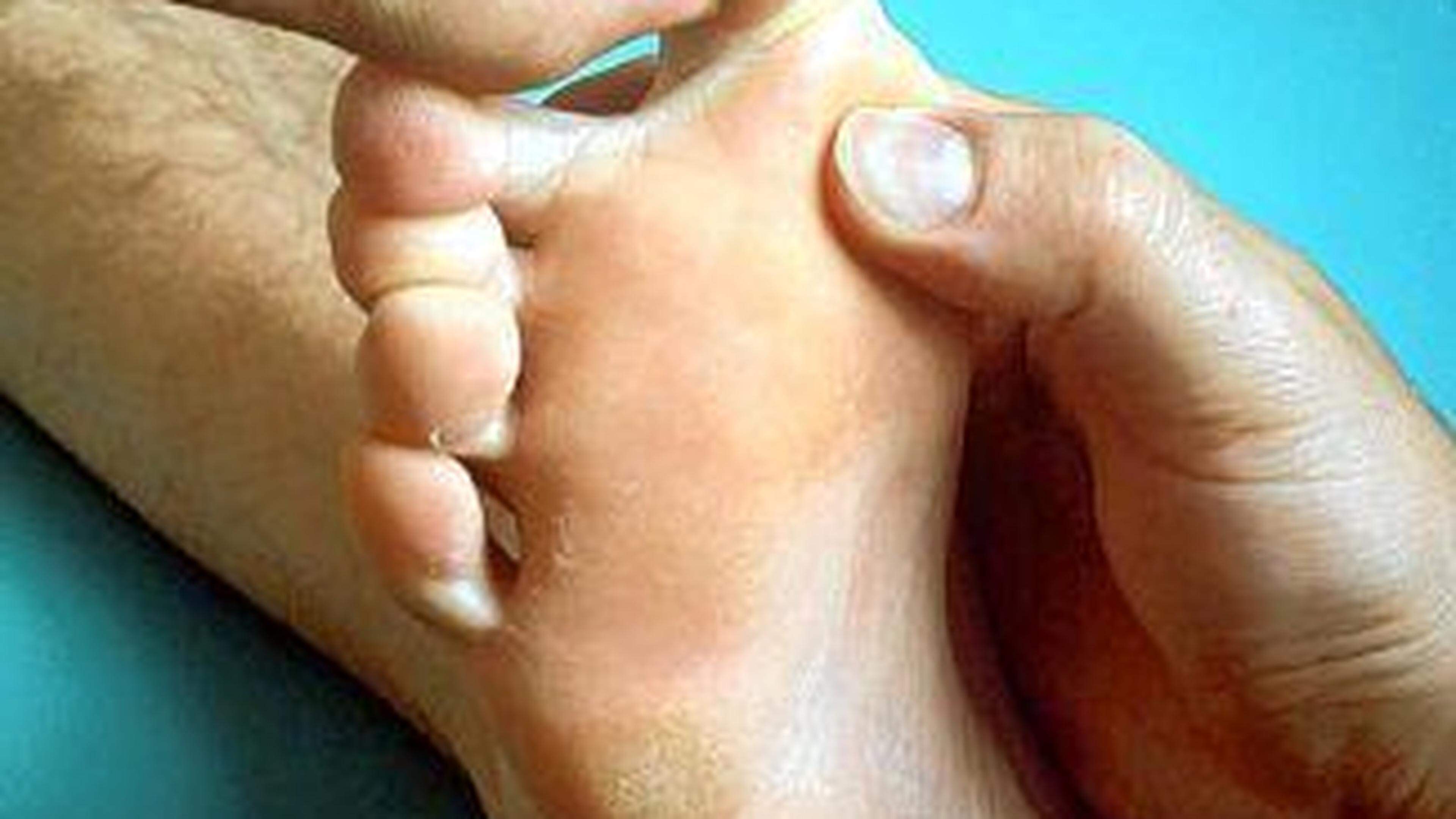 Schon vor etwa 5.000 Jahren entwickelte sich in der traditionellen chinesischen Medizin die Idee, dass jedes Organ und jeder Teil des Körpers einem bestimmten Bereich auf der Fußsohle zuzuordnen ist. So entstand die Fußreflexzonentherapie.