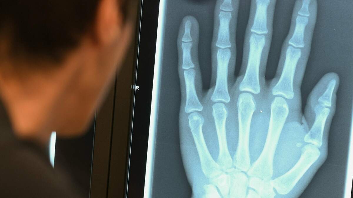Herr Röntgen verändert die Welt | Aachener Zeitung